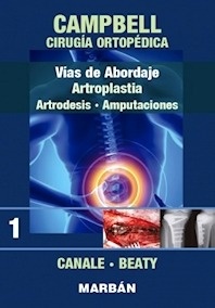 Vías de Abordaje. Artroplastia, Artrodesis y Amputaciones