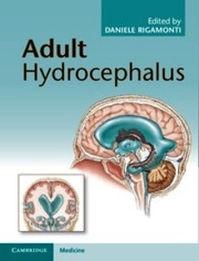 Adult Hydrocephalus