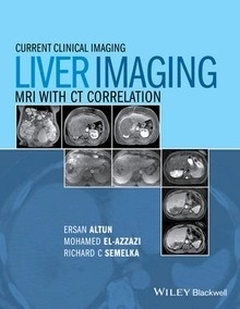 Liver Imaging "MRI with CT Correlation"