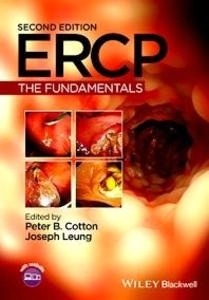 ERCP: The Fundamentals