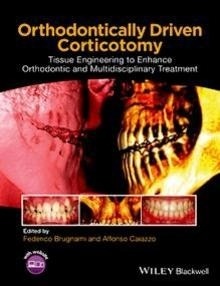 Orthodontically Driven Corticotomy "Tissue Engineering to Enhance Orthodontic and Multidisciplinary Treatment"