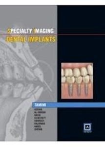 Specialty Imaging  Dental Implants