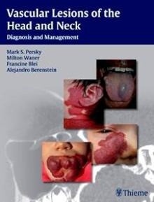 Vascular Lesions of the Head and Neck "Diagnosis and Management"