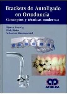Brackets de Autoligado en Ortodoncia "Conceptos y Técnicas Modernas"