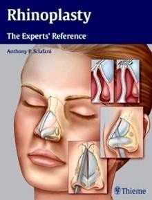 Rhinoplasty "The Experts' Reference"