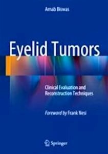 Eyelid Tumors "Clinical Evaluation and Reconstruction Techniques"