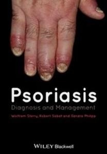 Psoriasis: Diagnosis and Management