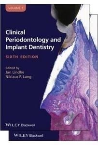 Clinical Periodontology And Implant Dentistry 2 Vols.