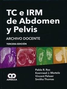 TC e IRM de Abdomen y Pelvis "Archivo Docente"