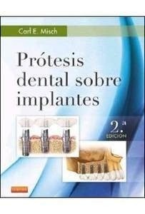 Prótesis Dental sobre Implantes