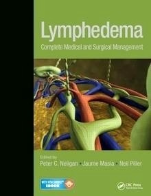 Lymphedema "Complete Medical and Surgical Management"