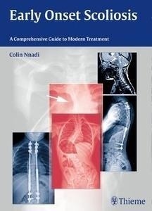 Early Onset Scoliosis "A Comprehensive Guide To Modern Treatment"