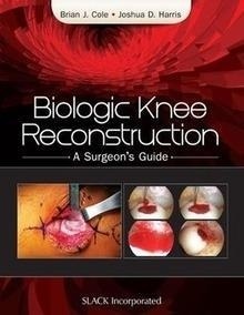 Biologic Knee Reconstruction "A Surgeon'S Guide"