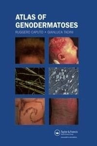Atlas Of Genodermatoses (Book + E-Book)