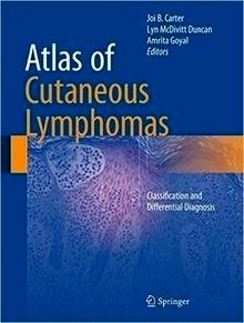 Atlas Of Cutaneous Lymphomas "Classification And Differential Diagnosis"