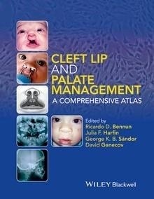 Cleft Lip and Palate Management "A Comprehensive Atlas"