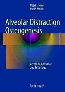 Alveolar Distraction Osteogenesis "Archwise Appliance And Technique"