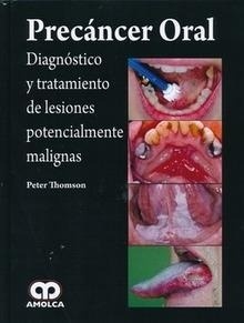 Precáncer Oral "Diagnóstico y Tratamiento de Lesiones Potencialmente Malignas"