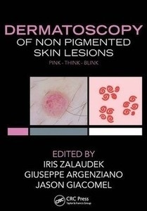 Dermatoscopy Of Non-Pigmented Skin Lesions "Pink - Think - Blink"