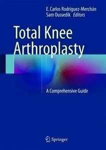 Total Knee Arthroplasty "A Comprehensive Guide"