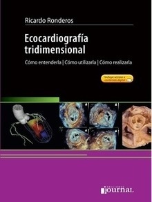 Ecocardiografia Tridimensional "Cómo Entenderla, Cómo Utilizarla, Cómo Realizarla"