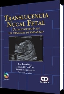 Translucencia Nucal Fetal