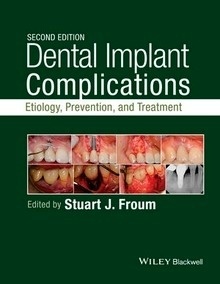 Dental Implant Complications "Etiology, Prevention, And Treatment"