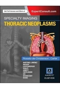 Thoracic Neoplasms "SPECIALTY IMAGING"