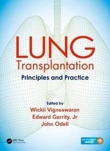 Lung Transplantation "Principles And Practice"