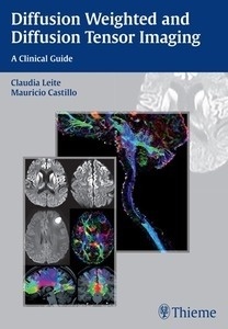 Diffusion Weighted and Diffusion Tensor Imaging "A Clinical Guide"