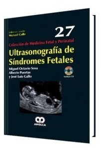 Ultrasonografía de Síndromes Fetales