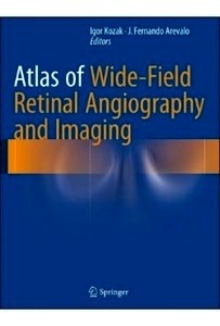 Atlas Of Wide-Field Retinal Angiography And Imaging
