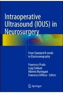 Intraoperative Ultrasound (IOUS) In Neurosurgery "From Standard B-Mode To Elastosonography"