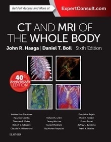 CT and MRI of the Whole Body 2 Vols.