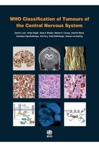WHO Classification Of Tumours Of The Central Nervous System
