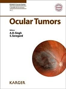 Ocular Tumors