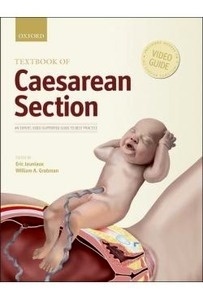 Textbook Of Caesarean Section