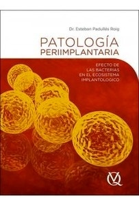 Patología Periimplantaria "Efecto de las Bacterias en el Ecosistema Implantológico"
