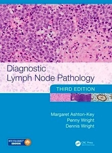 Diagnostic Lymph Node Pathology