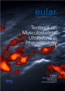 Textbook On Musculoskeletal Ultrasound In Rheumatology "Eular"
