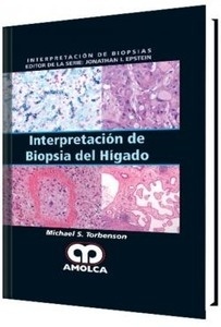 Interpretación de Biopsia del Hígado