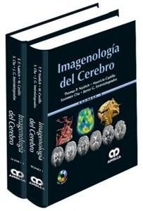 Imagenología del Cerebro 2 Vols.