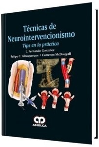 Técnicas de Neurointervencionismo Tips en la Práctica