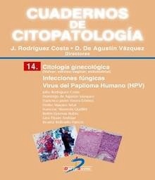 Cuadernos de Citopatología. Citología ginecológica "Infecciones fúngicas. Virus del Papiloma Humano (HPV)"