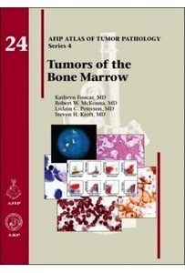 Tumors Of The Bone Marrow