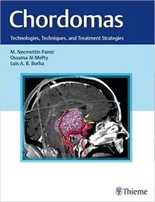 Chordomas "Technologies, Techniques, And Treatment Strategies"
