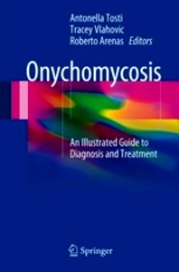 Onychomycosis "An Illustrated Guide to Diagnosis and Treatment"