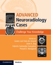 Advanced Neuroradiology Cases "Challenge Your Knowledge"