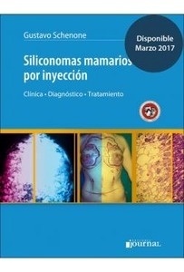 Siliconomas Mamarios por Inyección "Clínica  Diagnóstico y Tratamiento"