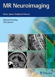 MR Neuroimaging "Brain, Spine, and Peripheral Nerves"